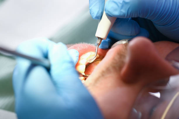 Professional Emergency Dentist in WV